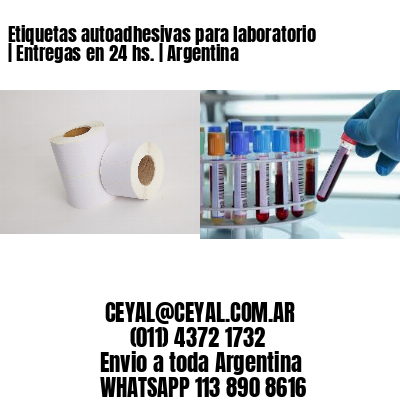 Etiquetas autoadhesivas para laboratorio | Entregas en 24 hs. | Argentina