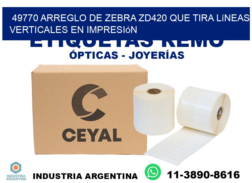 49770 arreglo de zebra zd420 que tira líneas verticales en impresión